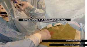 Técnica de Cirugía Endoscópica Percutanea