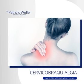 Cervicobraquialgia (Dolor Cervical) ¿De qué se trata?