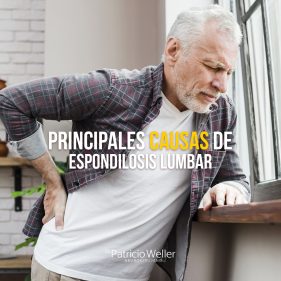 Conoce más sobre la Espondilosis Lumbar